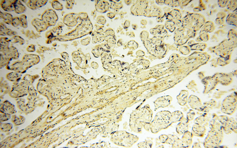 Immunohistochemical of paraffin-embedded human placenta using Catalog No:115599(SRPX2 antibody) at dilution of 1:100 (under 10x lens)
