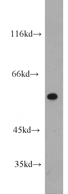 A375 cells were subjected to SDS PAGE followed by western blot with Catalog No:109506(CPEB1 antibody) at dilution of 1:1000