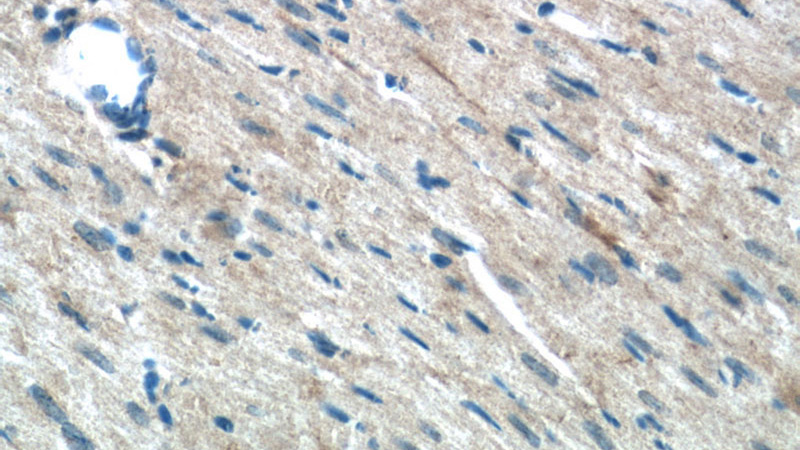 Immunohistochemistry of paraffin-embedded mouse heart tissue slide using Catalog No:109899(DSP Antibody) at dilution of 1:50 (under 40x lens)