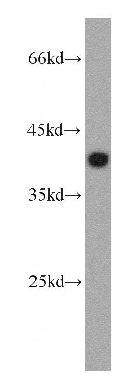 K-562 cells were subjected to SDS PAGE followed by western blot with Catalog No:110093(DNAJB2 antibody) at dilution of 1:300