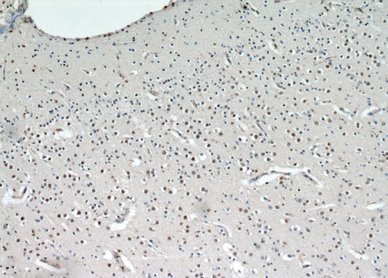 Immunohistochemical of paraffin-embedded human brain using Catalog No:108975(CCDC42 antibody) at dilution of 1:100 (under 10x lens)