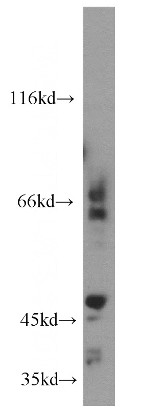 HepG2 cells were subjected to SDS PAGE followed by western blot with Catalog No:112881(MMP14 antibody) at dilution of 1:500