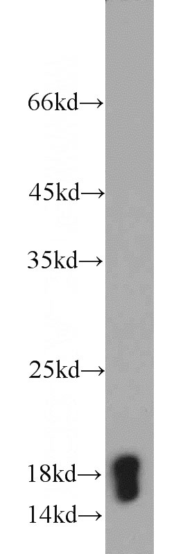 K-562 cells were subjected to SDS PAGE followed by western blot with Catalog No:109673(CYPA antibody) at dilution of 1:1500