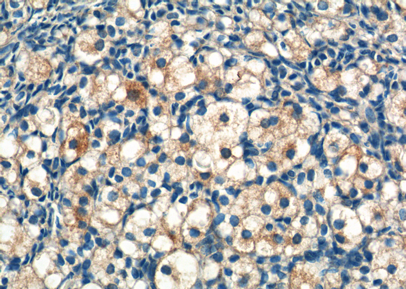 Immunohistochemistry of paraffin-embedded human ovary tissue slide using Catalog No:115676(STAR Antibody) at dilution of 1:50 (under 40x lens)