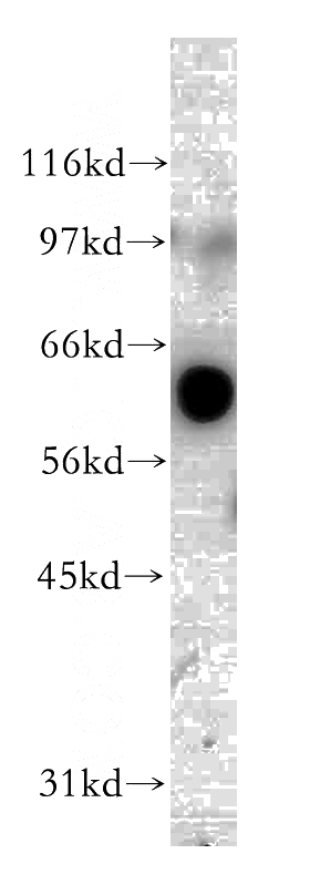 HEK-293 cells were subjected to SDS PAGE followed by western blot with Catalog No:110750(FUT8 antibody) at dilution of 1:500