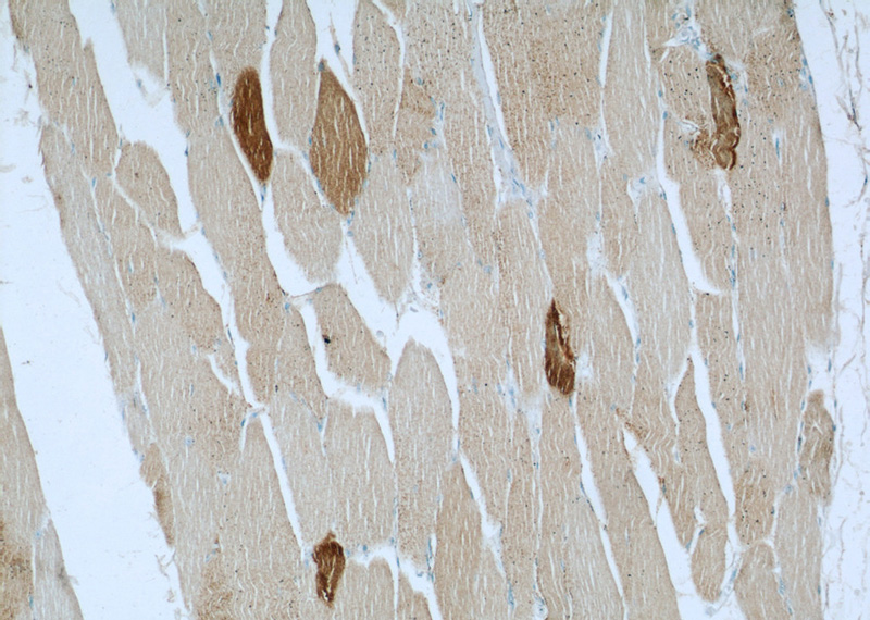 Immunohistochemical of paraffin-embedded human skeletal muscle using Catalog No:115625(ST3GAL5 antibody) at dilution of 1:50 (under 10x lens)