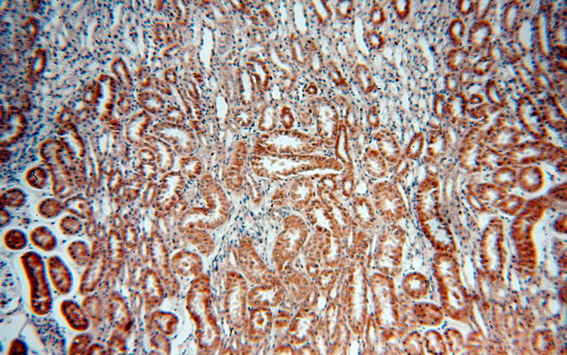 Immunohistochemical of paraffin-embedded human kidney using Catalog No:113627(PDK4 antibody) at dilution of 1:50 (under 10x lens)