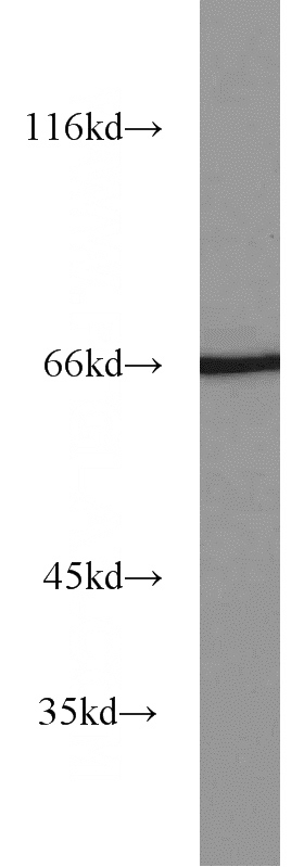 K-562 cells were subjected to SDS PAGE followed by western blot with Catalog No:114082(PPARG antibody) at dilution of 1:1000