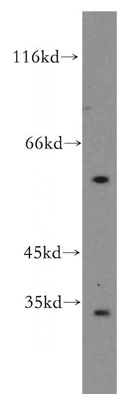 SH-SY5Y cells were subjected to SDS PAGE followed by western blot with Catalog No:111117(GPR162 antibody) at dilution of 1:500