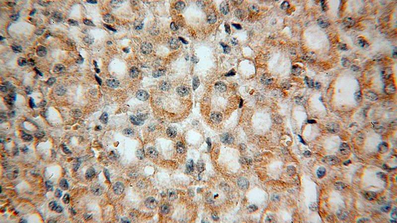 Immunohistochemical of paraffin-embedded human kidney using Catalog No:113639(PDSS2 antibody) at dilution of 1:50 (under 40x lens)