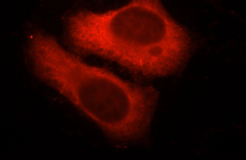 Immunofluorescent analysis of HepG2 cells, using F12 antibody Catalog No: at 1:25 dilution and Rhodamine-labeled goat anti-mouse IgG (red).