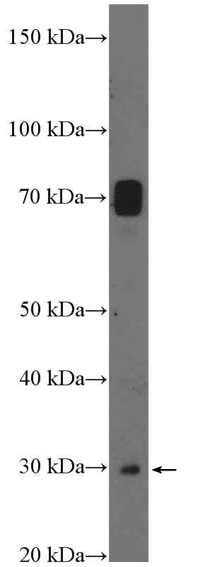 mouse liver tissue were subjected to SDS PAGE followed by western blot with Catalog No:114975(SAT1 Antibody) at dilution of 1:300