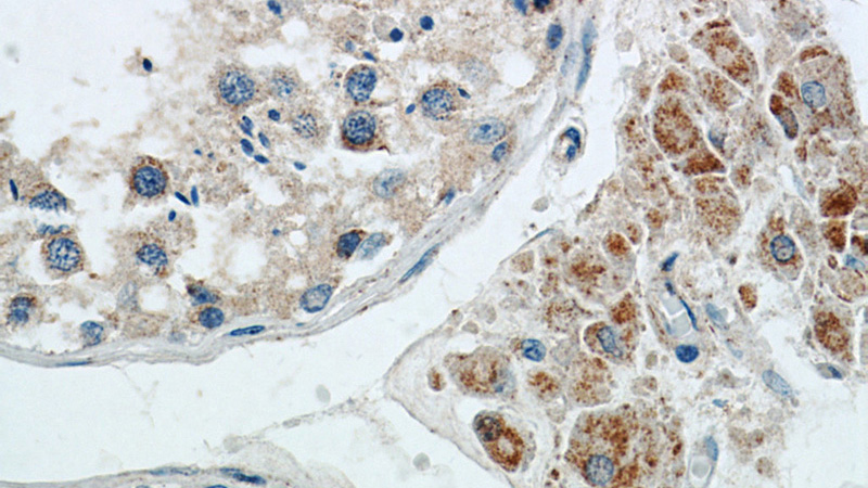 Immunohistochemical of paraffin-embedded human testis using Catalog No:112809(MRPL10 antibody) at dilution of 1:50 (under 40x lens)