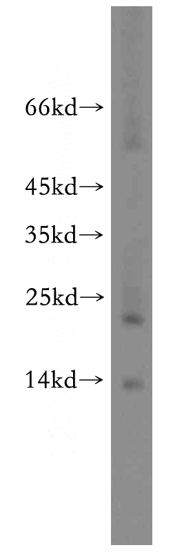 Jurkat cells were subjected to SDS PAGE followed by western blot with Catalog No:109149(KLRD1 antibody) at dilution of 1:500