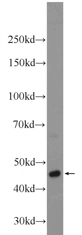 K-562 cells were subjected to SDS PAGE followed by western blot with Catalog No:112393(LUC7L2 Antibody) at dilution of 1:1500