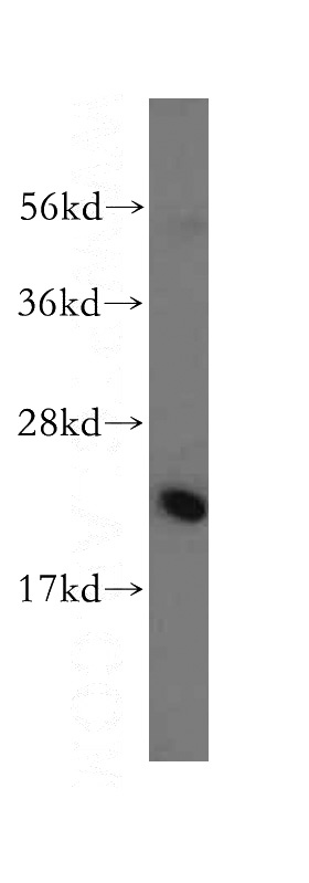 HepG2 cells were subjected to SDS PAGE followed by western blot with Catalog No:114879(RPL23A antibody) at dilution of 1:500