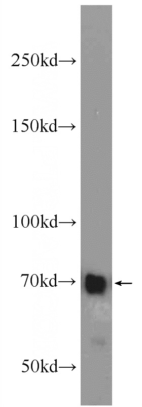 HepG2 cells were subjected to SDS PAGE followed by western blot with Catalog No:112204(LGALS3BP antibody) at dilution of 1:1000
