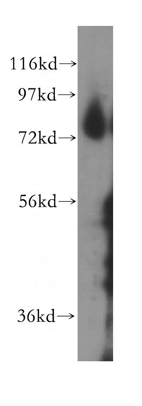human placenta tissue were subjected to SDS PAGE followed by western blot with Catalog No:116051(THOP1 antibody) at dilution of 1:500