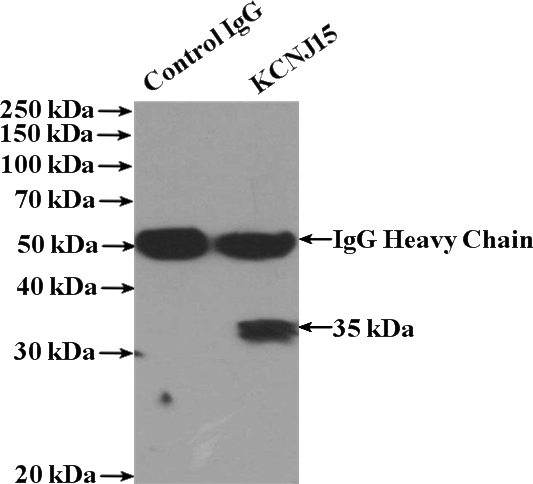 IP Result of anti-KCNJ15 (IP:Catalog No:111969, 4ug; Detection:Catalog No:111969 1:500) with HepG2 cells lysate 1000ug.