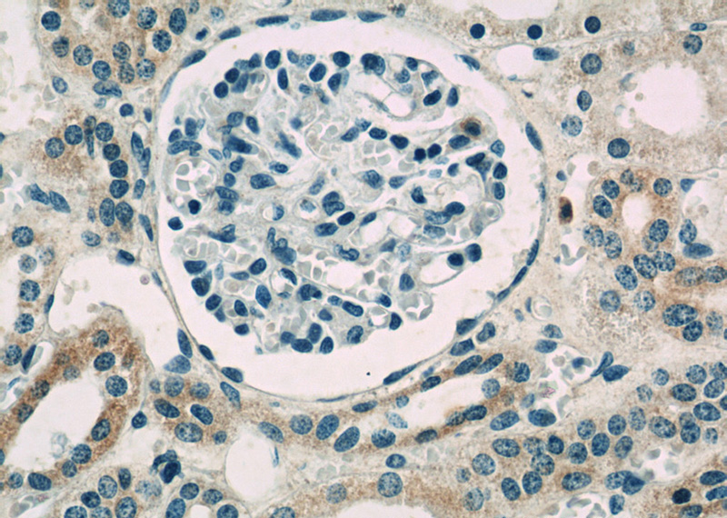 Immunohistochemistry of paraffin-embedded human kidney slide using Catalog No:115441(SNAI1 Antibody) at dilution of 1:50