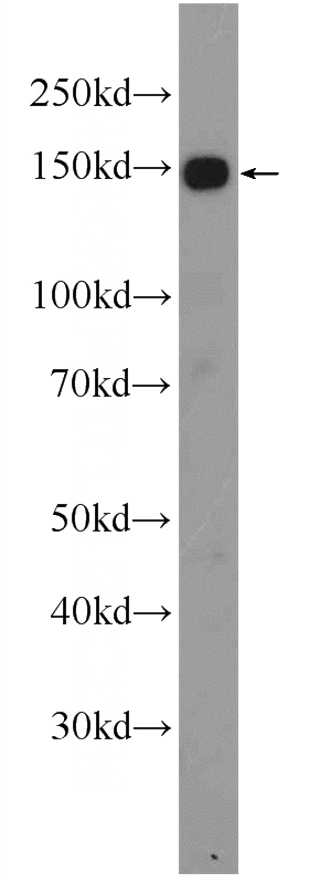 HeLa cells were subjected to SDS PAGE followed by western blot with Catalog No:109398(CLocK Antibody) at dilution of 1:1000