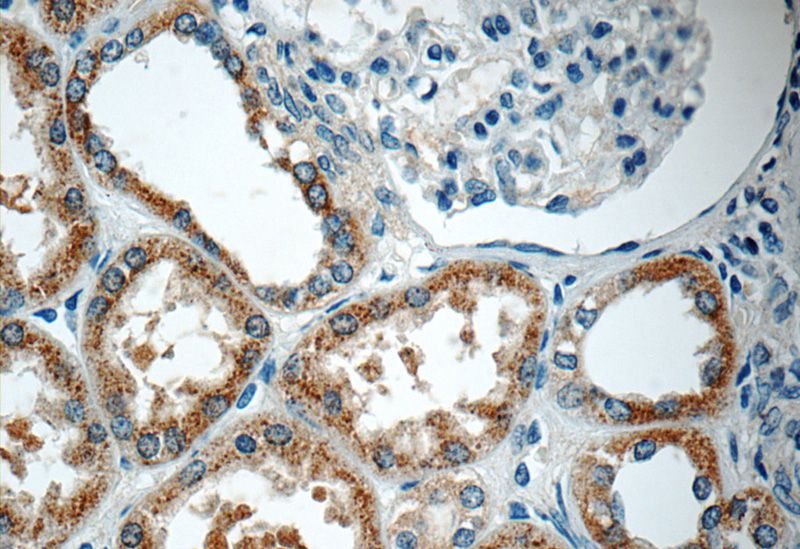 Immunohistochemistry of paraffin-embedded human kidney tissue slide using Catalog No:114137(PPM1L Antibody) at dilution of 1:50 (under 40x lens)