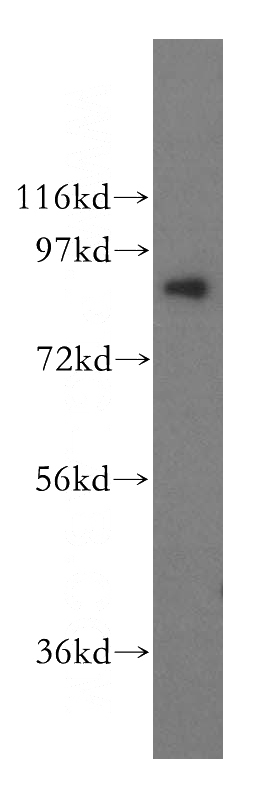 Jurkat cells were subjected to SDS PAGE followed by western blot with Catalog No:117098(BCL2L13 antibody) at dilution of 1:500