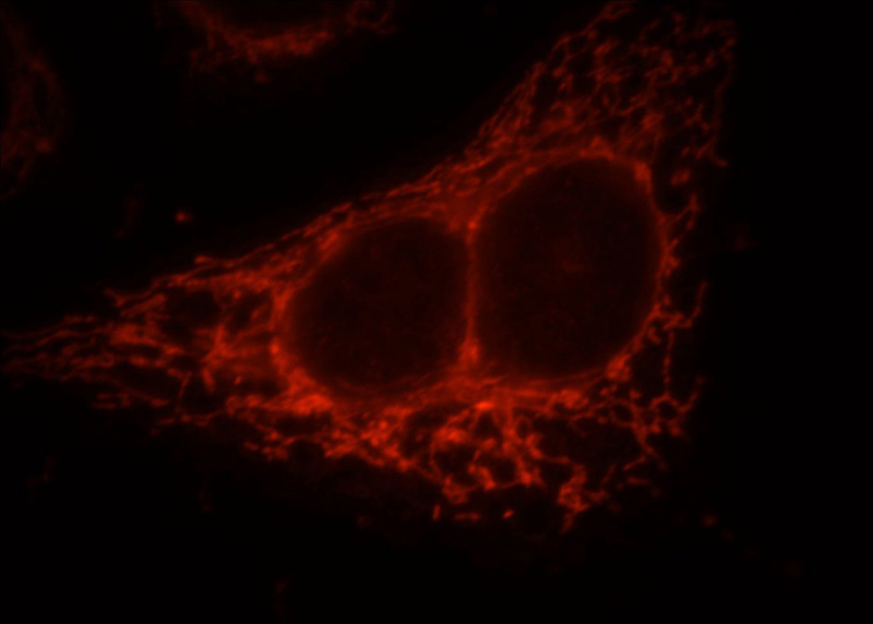 Immunofluorescent analysis of HepG2 cells, using FAM117B antibody Catalog No:110462 at 1:25 dilution and Rhodamine-labeled goat anti-rabbit IgG (red).