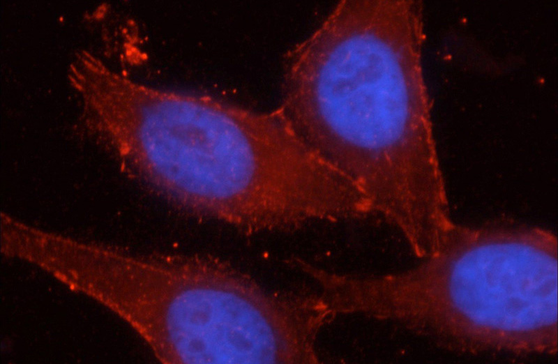 Immunofluorescent analysis of HepG2 cells, using CTNNB1 antibody Catalog No:117132 at 1:50 dilution and Rhodamine-labeled goat anti-rabbit IgG (red). Blue pseudocolor = DAPI (fluorescent DNA dye).