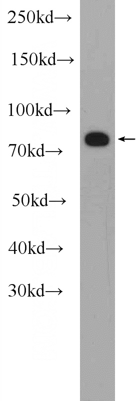 human plasma tissue were subjected to SDS PAGE followed by western blot with Catalog No:112639(MEFV Antibody) at dilution of 1:1000