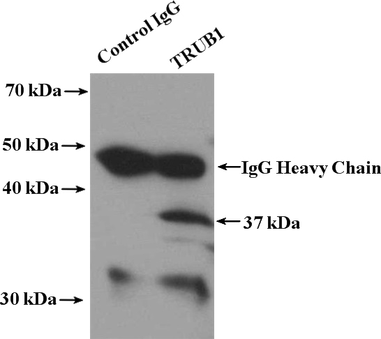 IP Result of anti-TRUB1 (IP:Catalog No:116420, 4ug; Detection:Catalog No:116420 1:300) with mouse liver tissue lysate 6400ug.