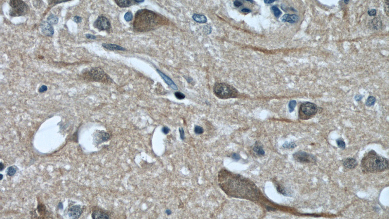Immunohistochemical of paraffin-embedded human brain using Catalog No:108822(CALHM1 antibody) at dilution of 1:50 (under 40x lens)