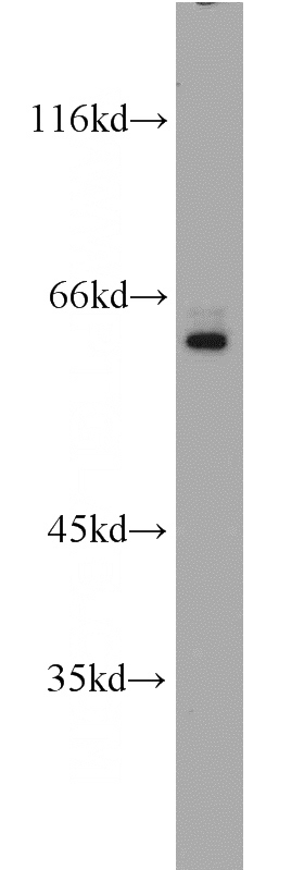 HeLa cells were subjected to SDS PAGE followed by western blot with Catalog No:115523(SP110 antibody) at dilution of 1:800