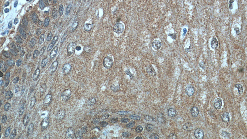 Immunohistochemical of paraffin-embedded human oesophagus using Catalog No:114312(PTP4A3 antibody) at dilution of 1:50 (under 40x lens)