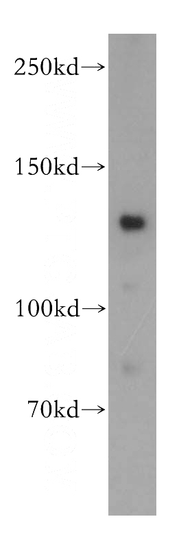 HepG2 cells were subjected to SDS PAGE followed by western blot with Catalog No:108856(CARD6 antibody) at dilution of 1:400