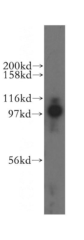 K-562 cells were subjected to SDS PAGE followed by western blot with Catalog No:112584(MED15 antibody) at dilution of 1:500