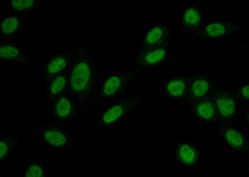 Immunofluorescent analysis of (10% Formaldehyde) fixed HeLa cells using Catalog No:116537(UBE2T Antibody) at dilution of 1:50 and Alexa Fluor 488-congugated AffiniPure Goat Anti-Rabbit IgG(H+L)