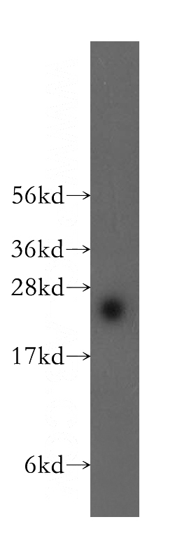 mouse thymus tissue were subjected to SDS PAGE followed by western blot with Catalog No:108197(ARL15 antibody) at dilution of 1:300