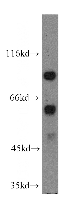 HEK-293 cells were subjected to SDS PAGE followed by western blot with Catalog No:112515(METT10D antibody) at dilution of 1:500