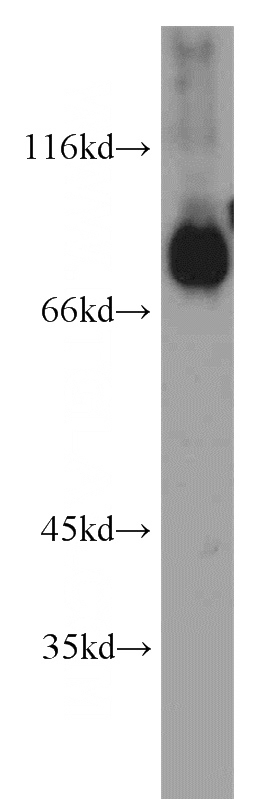human brain tissue were subjected to SDS PAGE followed by western blot with Catalog No:115754(SV2B antibody) at dilution of 1:1000