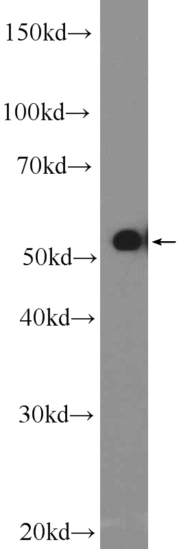 Raji cells were subjected to SDS PAGE followed by western blot with Catalog No:116844(WAS Antibody) at dilution of 1:600