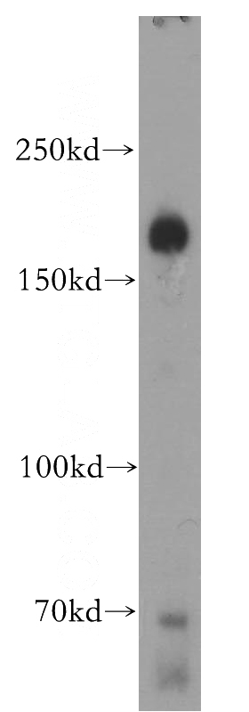 mouse brain tissue were subjected to SDS PAGE followed by western blot with Catalog No:109736(CTTNBP2 antibody) at dilution of 1:500