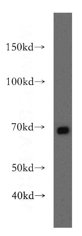 Jurkat cells were subjected to SDS PAGE followed by western blot with Catalog No:110333(ENTPD4 antibody) at dilution of 1:400