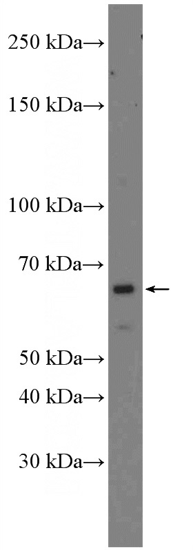 RAW 264.7 cells were subjected to SDS PAGE followed by western blot with Catalog No:116599(USP21 Antibody) at dilution of 1:600