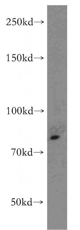 Jurkat cells were subjected to SDS PAGE followed by western blot with Catalog No:116290(TNFR2 antibody) at dilution of 1:500