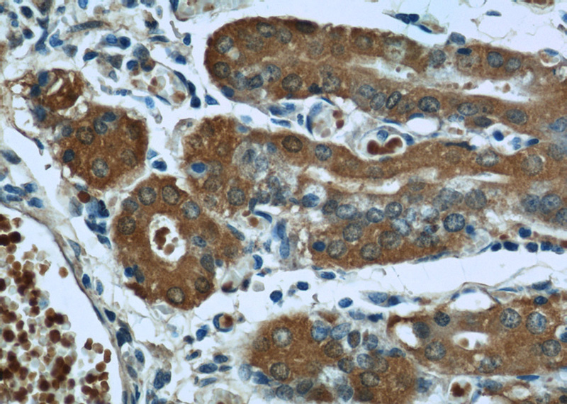 Immunohistochemistry of paraffin-embedded human stomach slide using Catalog No:107668(A4GNT Antibody) at dilution of 1:50