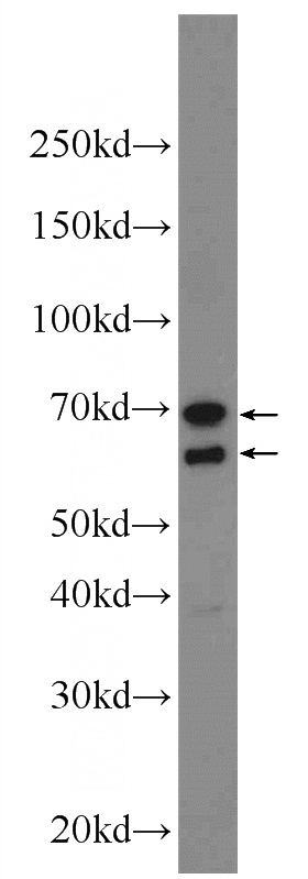 MCF-7 cells were subjected to SDS PAGE followed by western blot with Catalog No:112178(LCTL Antibody) at dilution of 1:1000