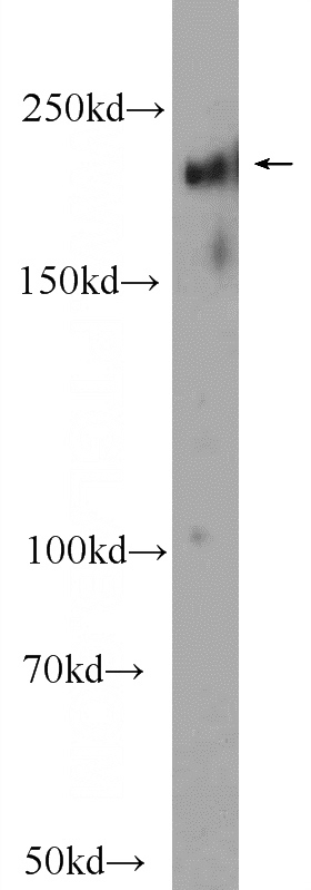 mouse brain tissue were subjected to SDS PAGE followed by western blot with Catalog No:107681(ABCA7 Antibody) at dilution of 1:1000
