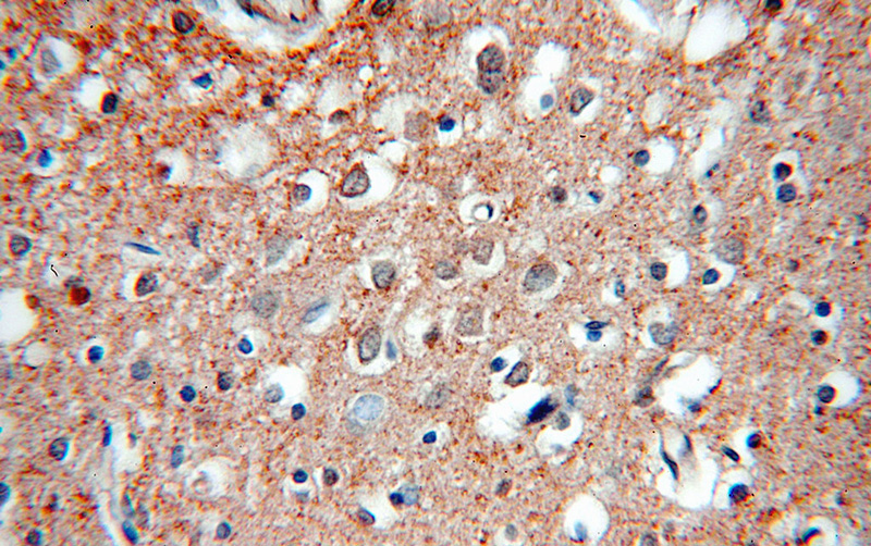 Immunohistochemical of paraffin-embedded human brain using Catalog No:115300(SLC12A5-Specific antibody) at dilution of 1:100 (under 40x lens)