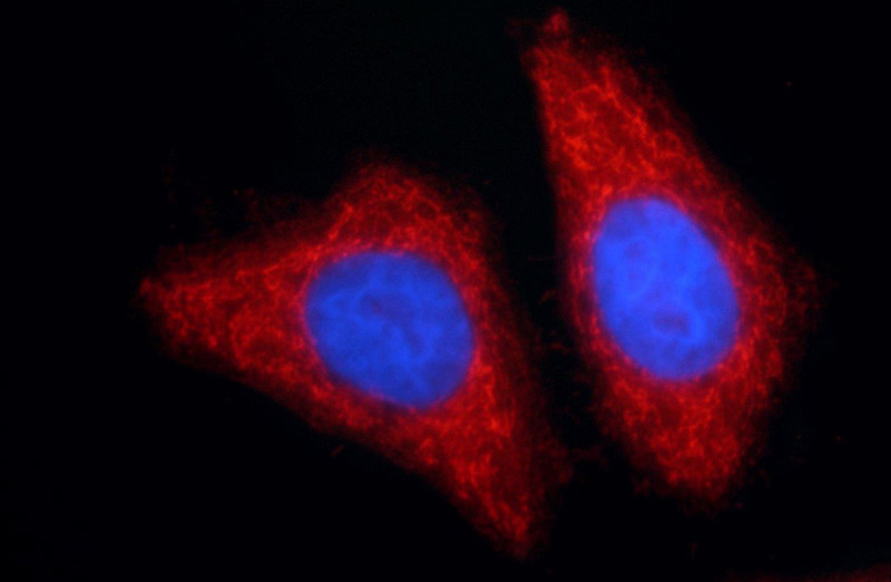 Immunofluorescent analysis of HepG2 cells using Catalog No:108085(ANKS1B Antibody) at dilution of 1:50 and Rhodamine-Goat anti-Rabbit IgG